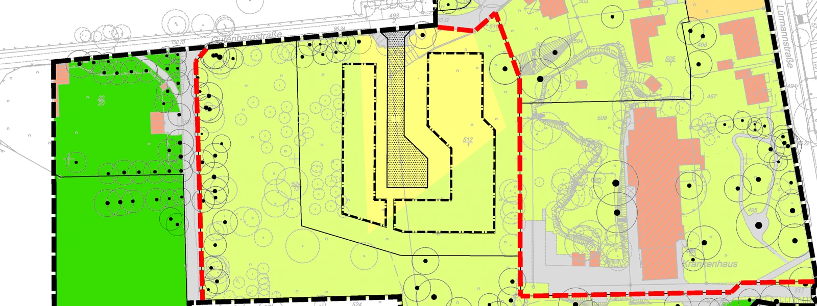 Bauleitplanung